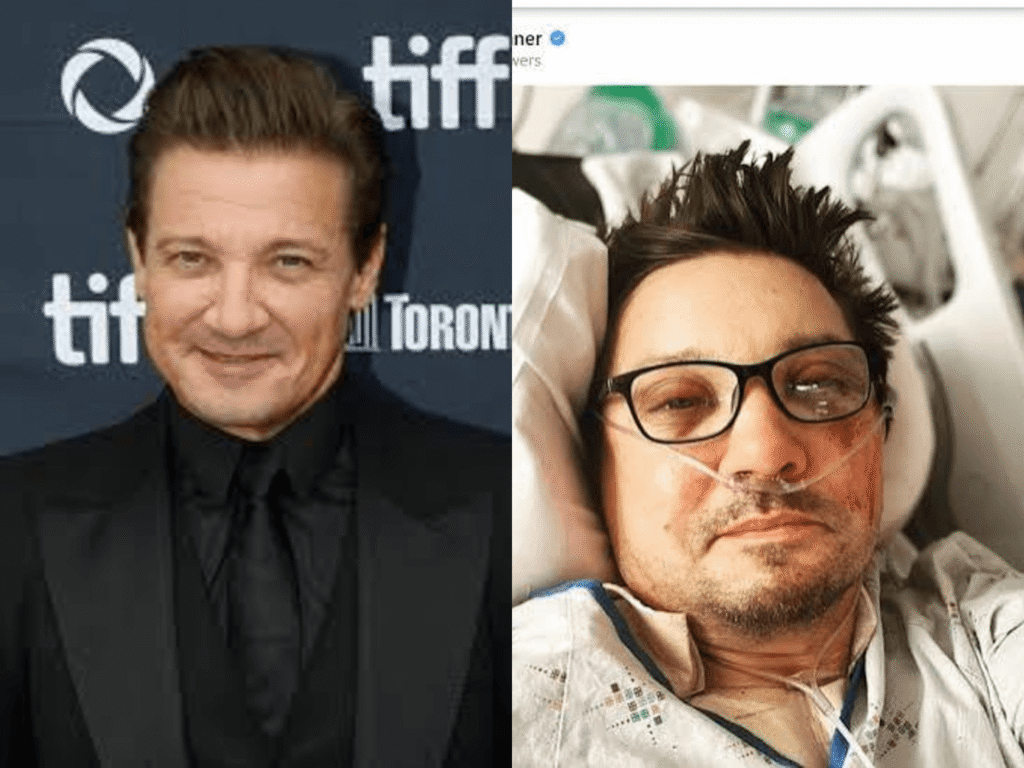 Jeremy Renner Accident: What Happened and His Recovery