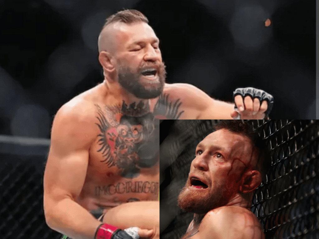 Conor McGregor Injury: Latest Updates and Recovery News